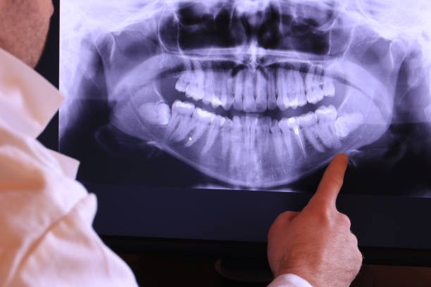 Best Orthodontic Emergency Dentist in Overton, TX