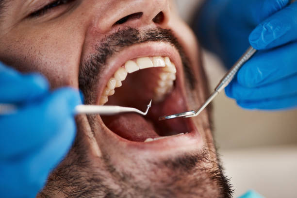 Best Emergency Dentist for Knocked-Out Tooth in Overton, TX