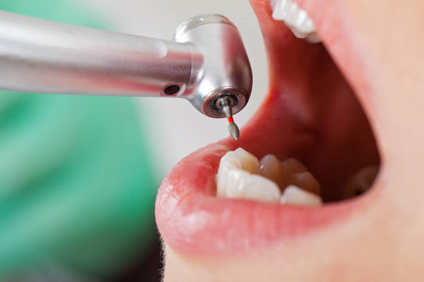 Best Urgent Dental Care for Toothache in Overton, TX